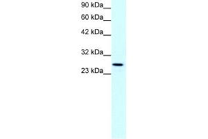 Human Jurkat; WB Suggested Anti-CLDN13 Antibody Titration: 1. (Claudin 13 (CLDN13) (C-Term) Antikörper)