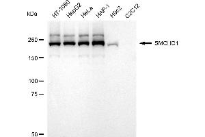 Western blotting analysis using SMCHD1 antibody (ABIN7800450).