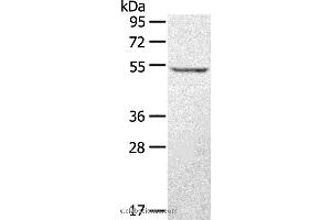 Western blot analysis of A431 cell, using STYK1 Polyclonal Antibody at dilution of 1:500 (STYK1 Antikörper)