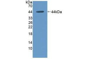 Western blot analysis of recombinant Rat HK1. (Hexokinase 1 Antikörper  (AA 413-540))