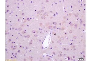 Formalin-fixed and paraffin embedded rat brain labeled with Rabbit Anti LGI1/ETL1 Polyclonal Antibody, Unconjugated (ABIN720430) at 1:200 followed by conjugation to the secondary antibody and DAB staining