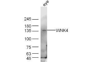 Mouse eye lysates probed with WNK4 Polyclonal Antibody, Unconjugated  at 1:300 dilution and 4˚C overnight incubation. (WNK4 Antikörper  (AA 351-450))