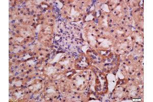 Formalin-fixed and paraffin embedded rat kidney labeled with Rabbit Anti-ATG9A(Ser735) Polyclonal Antibody, Unconjugated (ABIN756307) at 1:200 followed by conjugation to the secondary antibody and DAB staining (ATG9A Antikörper  (pSer735))