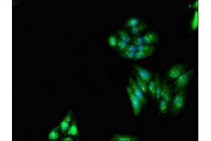 Immunofluorescent analysis of HepG2 cells using ABIN7151204 at dilution of 1:100 and Alexa Fluor 488-congugated AffiniPure Goat Anti-Rabbit IgG(H+L)