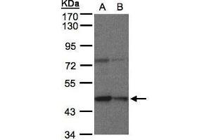 WB Image Sample(30 μg of whole cell lysate) A:HeLa S3, B:Hep G2, 7. (CPB1 Antikörper)