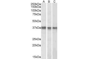 ABIN571286 (1µg/ml) staining of K562 (A), MCF7 (B) and Mouse Liver (C) lysates (35µg protein in RIPA buffer). (POLDIP2 Antikörper  (Internal Region))