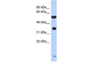 Western Blotting (WB) image for anti-Protease, serine, 48 (PRSS48) antibody (ABIN2460080) (ESSPL Antikörper)