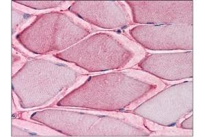 Human Skeletal Muscle: Formalin-Fixed, Paraffin-Embedded (FFPE) (SLC1A5 Antikörper  (Internal Region))