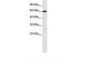 Image no. 2 for anti-Dachshund 2 (DACH2) (AA 525-574) antibody (ABIN6735937) (DACH2 Antikörper  (AA 525-574))