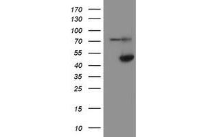 Western Blotting (WB) image for anti-Alcohol Dehydrogenase 7 (Class IV), mu Or sigma Polypeptide (ADH7) antibody (ABIN1496481)
