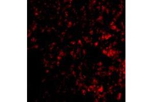 Immunofluorescence of PRDM1 in mouse lung tissue with PRDM1 polyclonal antibody  at 20 ug/mL .