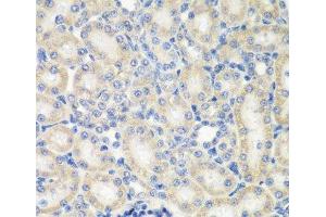 Immunohistochemistry of paraffin-embedded Rat kidney using NAA50 Polyclonal Antibody at dilution of 1:200 (40x lens). (NAA50 Antikörper)
