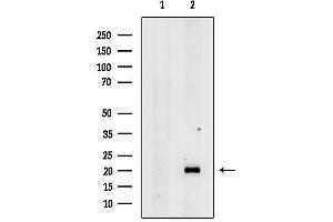 anti-Slow Skeletal Troponin T (TNNT1) (N-Term) antibody