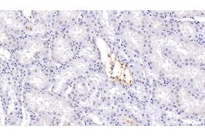 Immunohistochemistry (IHC) image for anti-Cystic Fibrosis Transmembrane Conductance Regulator (ATP-Binding Cassette Sub-Family C, Member 7) (CFTR) antibody (ABIN7434899)