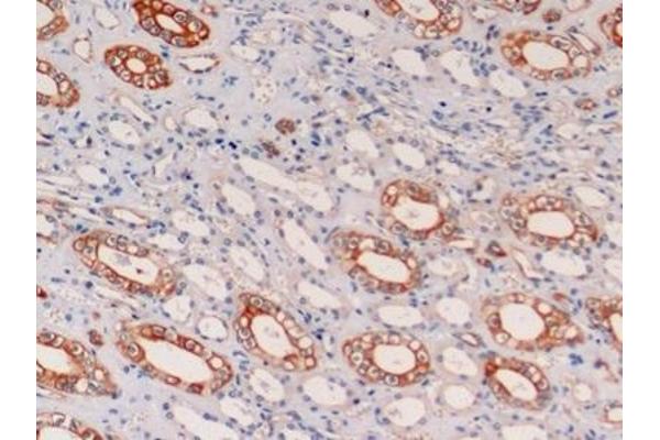 Cytokeratin 19 Antikörper  (AA 245-391)