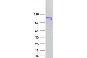 Validation with Western Blot (SUN2 Protein (Myc-DYKDDDDK Tag))
