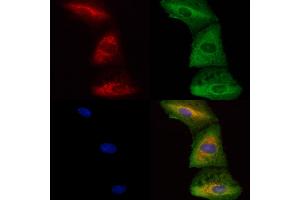 ABIN6262986 and ABIN6278409 staining  cells by IF/ICC. (LMAN1 Antikörper  (Internal Region))