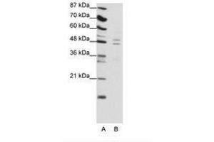 Image no. 1 for anti-TRAF Family Member-Associated NFKB Activator (TANK) (C-Term) antibody (ABIN6736133) (TANK Antikörper  (C-Term))