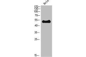Western Blot analysis of Hela cells using ETBR Polyclonal Antibody diluted at 1:500. (EDNRB Antikörper  (AA 31-80))