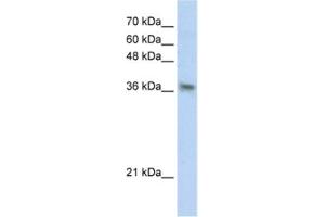 Western Blotting (WB) image for anti-Phytanoyl-CoA 2-Hydroxylase Interacting Protein (PHYHIP) antibody (ABIN2460831) (PHYHIP Antikörper)
