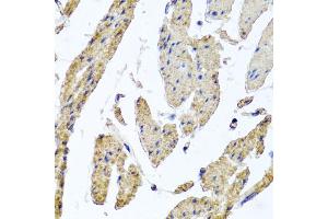 Immunohistochemistry of paraffin-embedded human esophageal smooth muscle using MRPL12 antibody (ABIN5974554) at dilution of 1/100 (40x lens). (MRPL12 Antikörper)