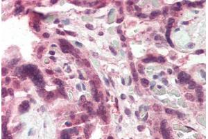 Human Placenta (formalin-fixed, paraffin-embedded) stained with CCKBR antibody ABIN337053 at 5 ug/ml followed by biotinylated anti-goat IgG secondary antibody ABIN481715, alkaline phosphatase-streptavidin and chromogen. (CCKBR Antikörper  (AA 251-266))