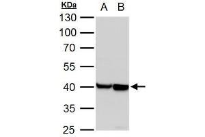 WB Image alpha Actin (cardiac muscle) antibody detects alpha Actin (cardiac muscle) protein by western blot analysis. (ACTC1 Antikörper)
