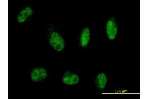 Immunofluorescence of purified MaxPab antibody to MTMR8 on HepG2 cell.