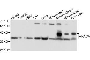 Western blot analysis of extracts of various cell lines, using NACA antibody (ABIN4904484) at 1:1000 dilution. (NACA Antikörper)