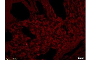 Formalin-fixed and paraffin embedded rat skin tissue labeled with Rabbit Anti-CD272/BTLA Polyclonal Antibody (ABIN671031), Unconjugated at 1:200 followed by conjugation to the secondary antibody and DAB staining. (BTLA Antikörper  (AA 221-289))