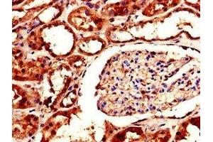 Immunohistochemistry (IHC) image for anti-Aldo-Keto Reductase Family 1, Member A1 (Aldehyde Reductase) (AKR1A1) (AA 2-325) antibody (ABIN7143637)