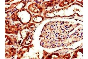 Immunohistochemistry of paraffin-embedded human kidney tissue using ABIN7143637 at dilution of 1:100 (AKR1A1 Antikörper  (AA 2-325))