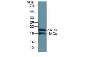Western blot analysis of recombinant Human IL1RAP. (IL1RAP Antikörper  (AA 420-558))