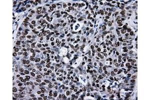 Image no. 21 for anti-Replication Protein A2, 32kDa (RPA2) antibody (ABIN1500733)