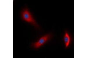 Immunofluorescent analysis of HER3 staining in A549 cells. (ERBB3 Antikörper  (C-Term))