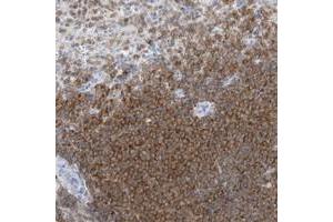 Immunohistochemical staining of human spleen with PSD4 polyclonal antibody  shows strong cytoplasmic positivity in cells of white pulp.