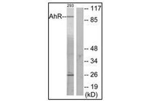 Western blot analysis of extracts from 293 cells, using AhR Antibody. (Aryl Hydrocarbon Receptor Antikörper  (N-Term))