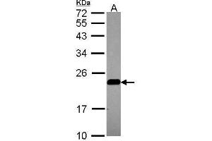 WB Image Sample (30 ug of whole cell lysate) A: A549 12% SDS PAGE antibody diluted at 1:1000 (Caveolin 2 Antikörper  (N-Term))