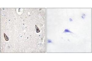Immunohistochemistry analysis of paraffin-embedded human brain tissue, using ADCY5/6 Antibody. (ADCY5/6 Antikörper  (AA 931-980))