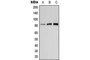 Western blot analysis of PIK3R6 expression in HepG2 (A), mouse brain (B), rat brain (C) whole cell lysates. (PIK3R6 Antikörper  (Center))
