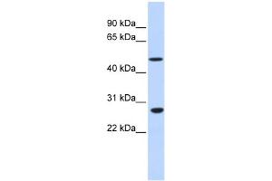 WB Suggested Anti-ZNF556 Antibody Titration:  0. (ZNF556 Antikörper  (N-Term))