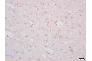 Formalin-fixed and paraffin embedded rat brain labeled with Anti-ST18/Znf387 Polyclonal Antibody, Unconjugated (ABIN1386039) at 1:200 followed by conjugation to the secondary antibody and DAB staining