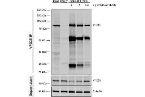 Immunoprecipitation analysis using Mouse Anti-VPS35 Monoclonal Antibody, Clone 7E4 (ABIN6932908). (VPS35 Antikörper)