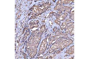 IHC analysis of Scavenging Receptor SRB2/SCARB2 using anti-Scavenging Receptor SRB2/SCARB2 antibody (ABIN7601833).