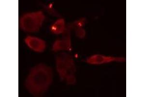 ABIN6275105 staining Hela cells by IF/ICC. (ELOVL1 Antikörper  (Internal Region))