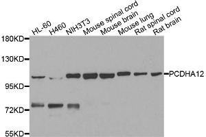 Western blot analysis of extracts of various cell lines, using PCDHA12 antibody. (PCDHA12 Antikörper)