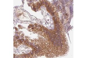 AMPK1 Antibody for IHC in human gallbladder tissue (PRKAA1 Antikörper  (C-Term))