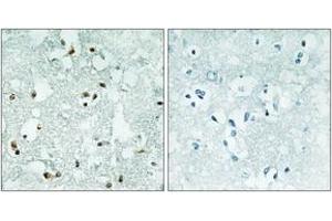 Immunohistochemistry analysis of paraffin-embedded human brain, using ELAC2 Antibody. (ELAC2 Antikörper  (AA 161-210))