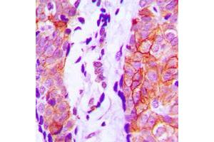 Immunohistochemical analysis of Cystatin 11 staining in human prostate formalin fixed paraffin embedded tissue section.