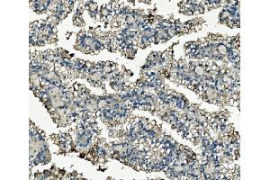 IHC analysis of Clathrin heavy chain/CLTC using anti-Clathrin heavy chain/CLTC antibody (ABIN7602703). (Clathrin Heavy Chain (CLTC) (AA 967-1668) Antikörper)